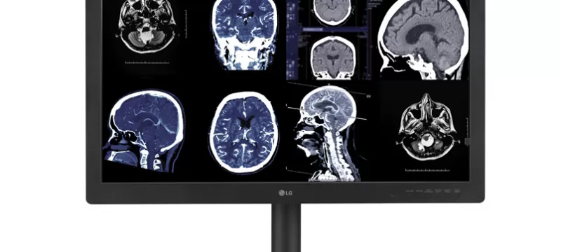 monitor de diagnóstico IPS Black de LG Electronics