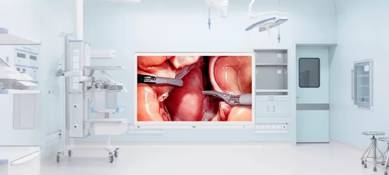 LG 32HS710S monitor quirúrgico