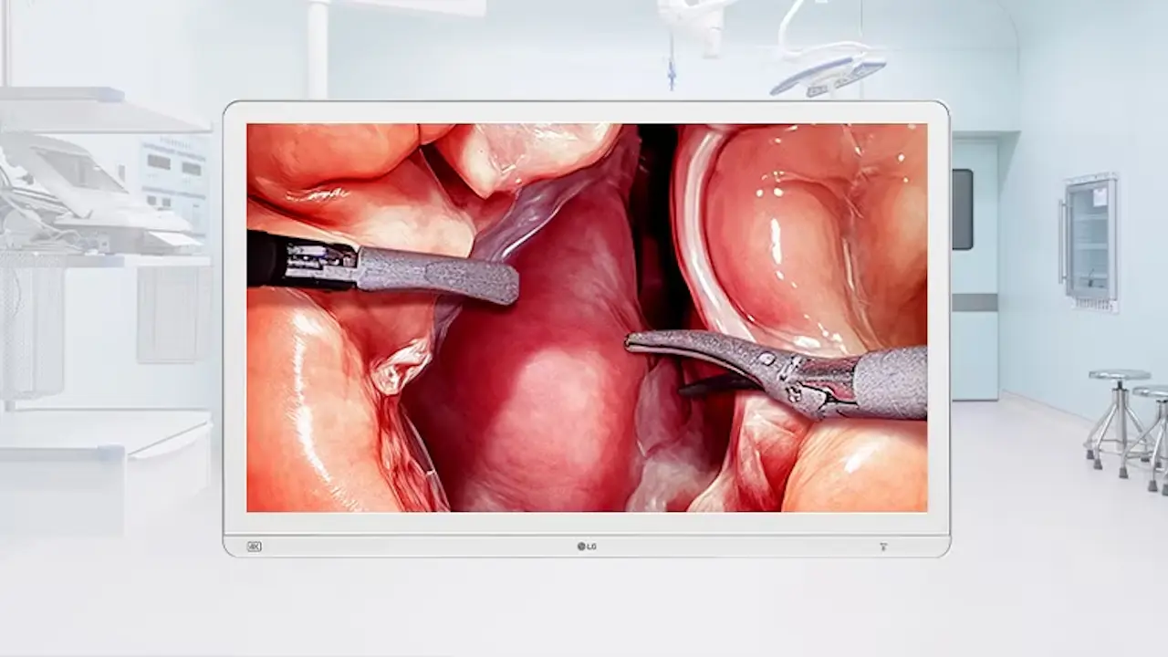 Monitor quirúrgico LG 32HS710S monitor quirurgico